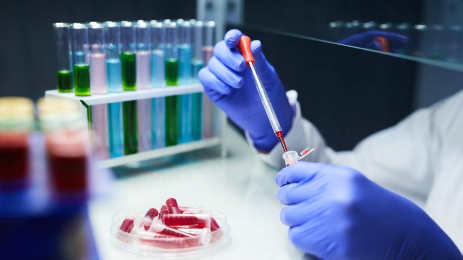 ANS define teste sorológico para o novo coronavírus como cobertura obrigatória de planos de saúde ANS define teste sorológico para o novo coronavírus como cobertura obrigatória de planos de saúde