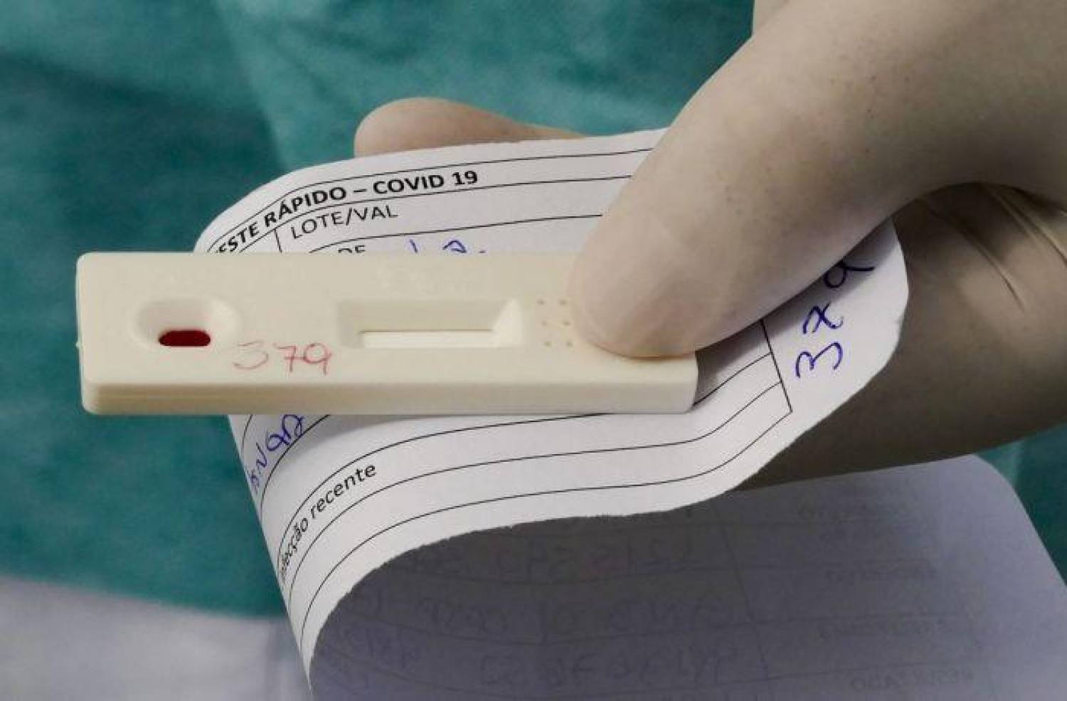 Dominante no mundo, nova variante mais contagiosa da Covid chega ao Brasil Dominante no mundo, nova variante mais contagiosa da Covid chega ao Brasil